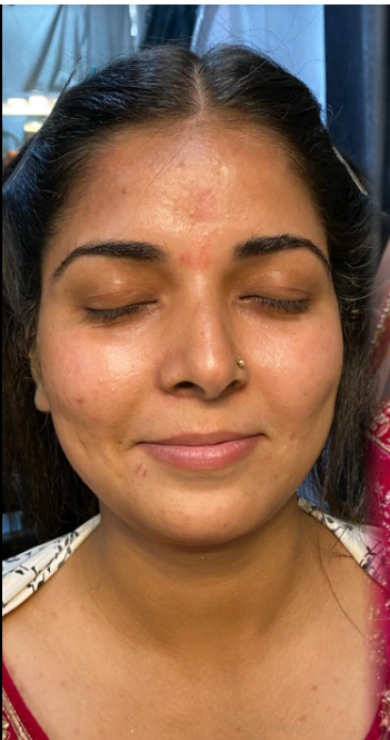 Before Makeup 2